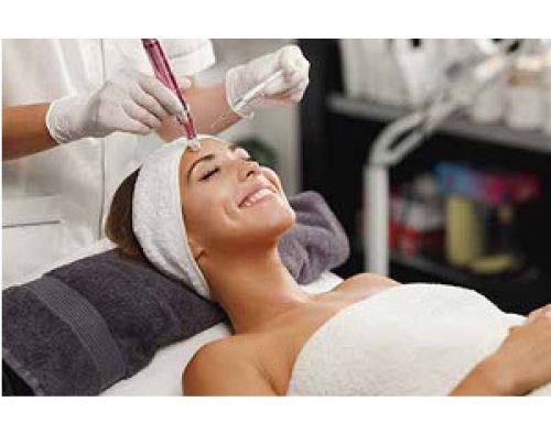 Microneedling